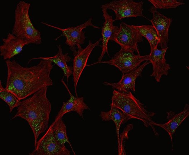 BPAE cells were fixed and permeabilized using the Image-iTÂ® Fixation/Permeabilization Kit (R37602), labeled with an anti-PMP70 (peroxisomes) antibody (713800), and stained with an Alexa FluorÂ® 488 Goat Anti-Mouse secondary antibody (A11029), Alexa FluorÂ® 594 phalloidin (A12381) and Hoechst 33342 (H3570). Images were acquired on a Nikon upright miscroscope (20x).